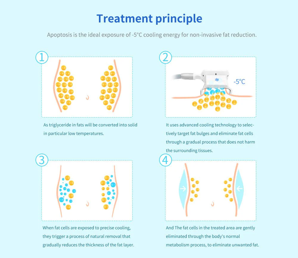 Shape Tactics - Cryolipolysis Cold Vacuum Fat Freezing for Cellulite Removal and Body Shaping Slimming Machine - Image 15