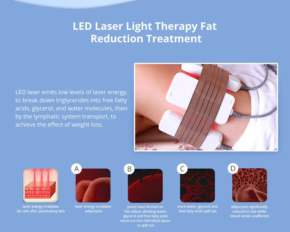 Shape Tactics 5-in-1 Cavitation 40K RF 5mw Device - Image 9