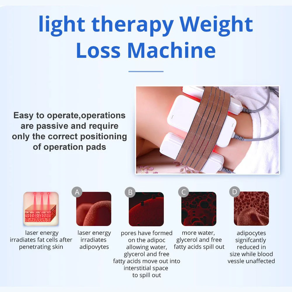 Shape Tactics 5-in-1 RF 40K Cavitation - Image 8