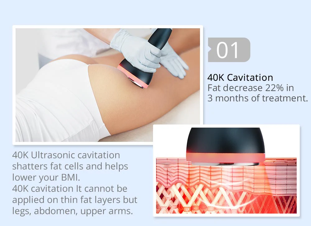 Shape Tactics 5-in-1 RF Ultrasonic Cavitation Machine with 40K Ultrasound - Image 11