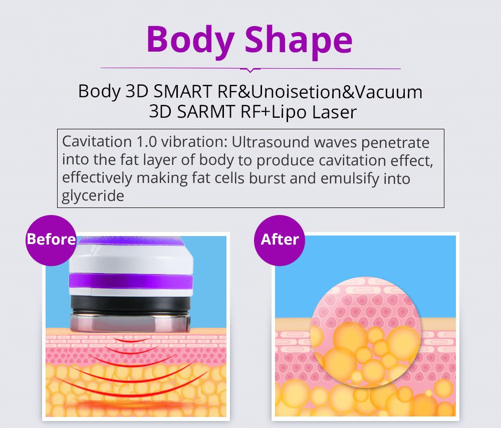 Shape Tactics 6-in-1 2.0 Cavitation 40K LED Radio Frequency - Image 10