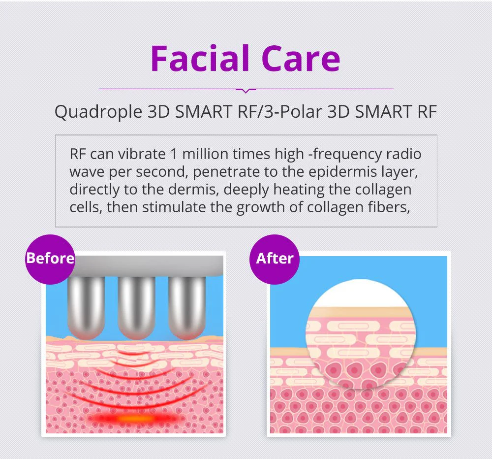 Shape Tactics 6-in-1 2.0 Cavitation 40K LED Radio Frequency - Image 11