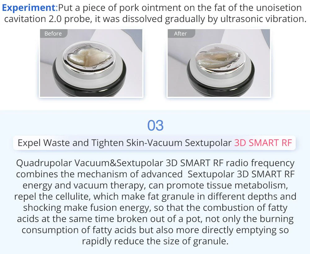 Shape Tactics 6-in-1 Advanced Unoisetion Cavitation 2.0 Vacuum RF Body Sculpting - Image 13