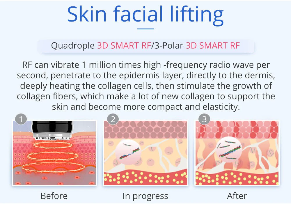 Shape Tactics 6-in-1 Advanced Unoisetion Cavitation 2.0 Vacuum RF Body Sculpting - Image 17