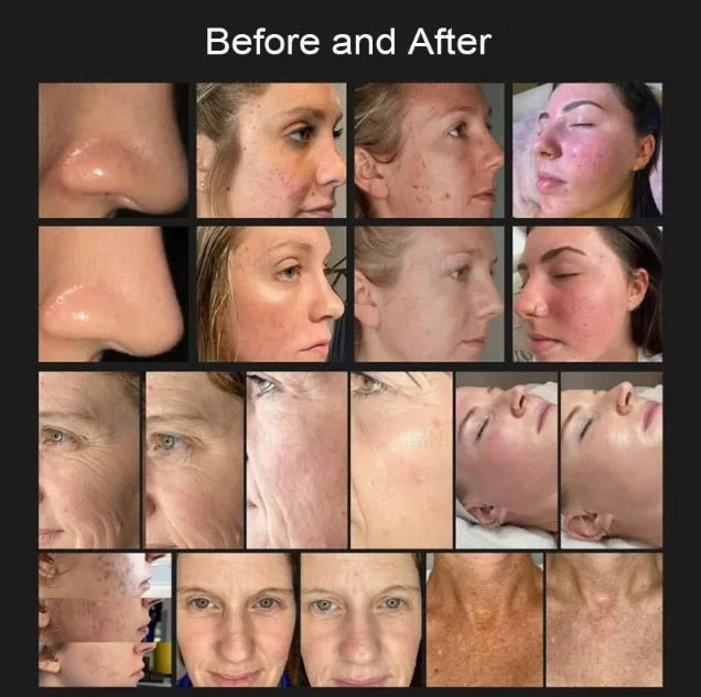 Shape Tactics 8-in-1 Hot & Cold Fusion Plasma Facial Beauty System - Image 11