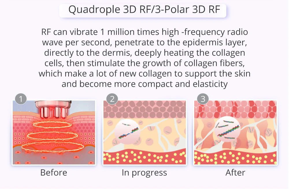 Shape Tactics - 9-in-1 Lipo Microcurrent Photon Ultrasonic Cavitation - Image 17