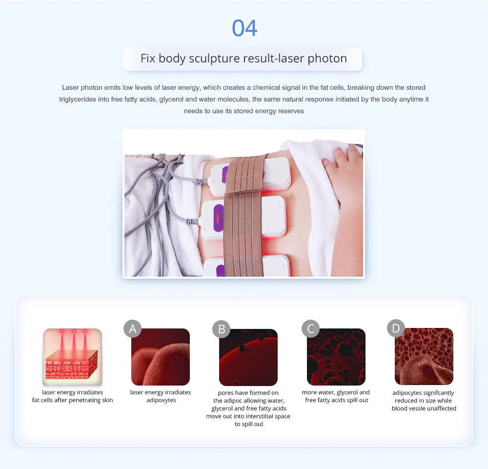 Shape Tactics - Advanced 8-in-1 Unoisetion Cavitation RF with LED Laser Pads - Image 13