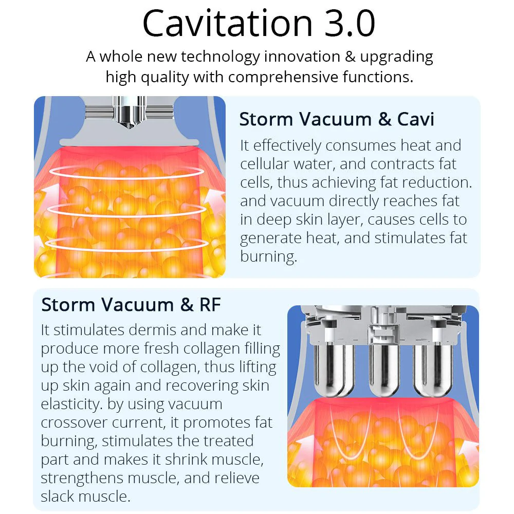 Shape Tactics CaVstorm 40K Cavitation 3.0 Machine with 4-in-1 Functionality - Image 12