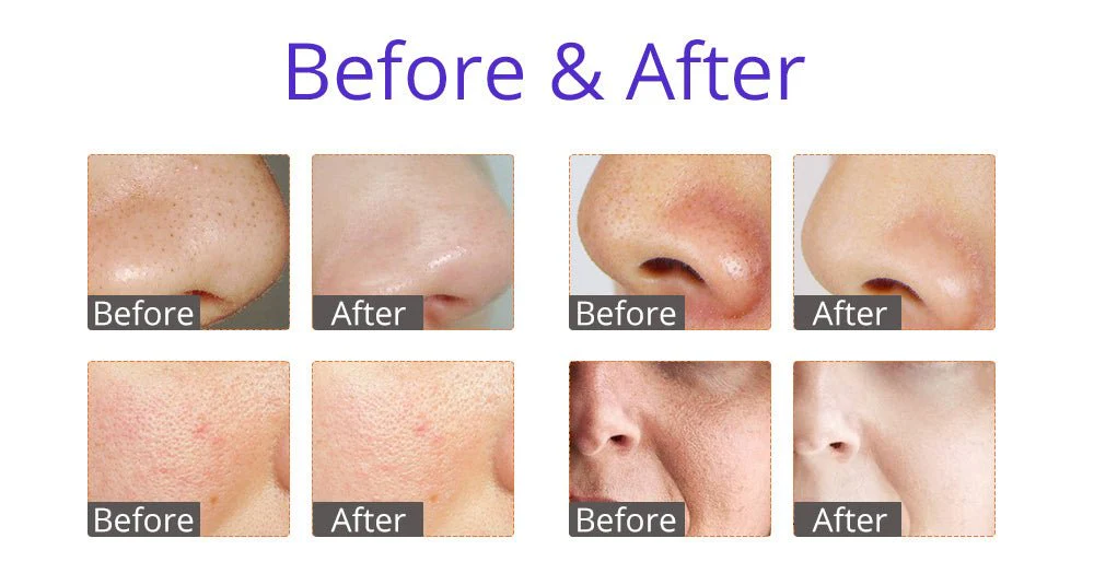 Shape Tactics - HydroGlow Pro: 6-in-1 Facial Beauty System - Image 13