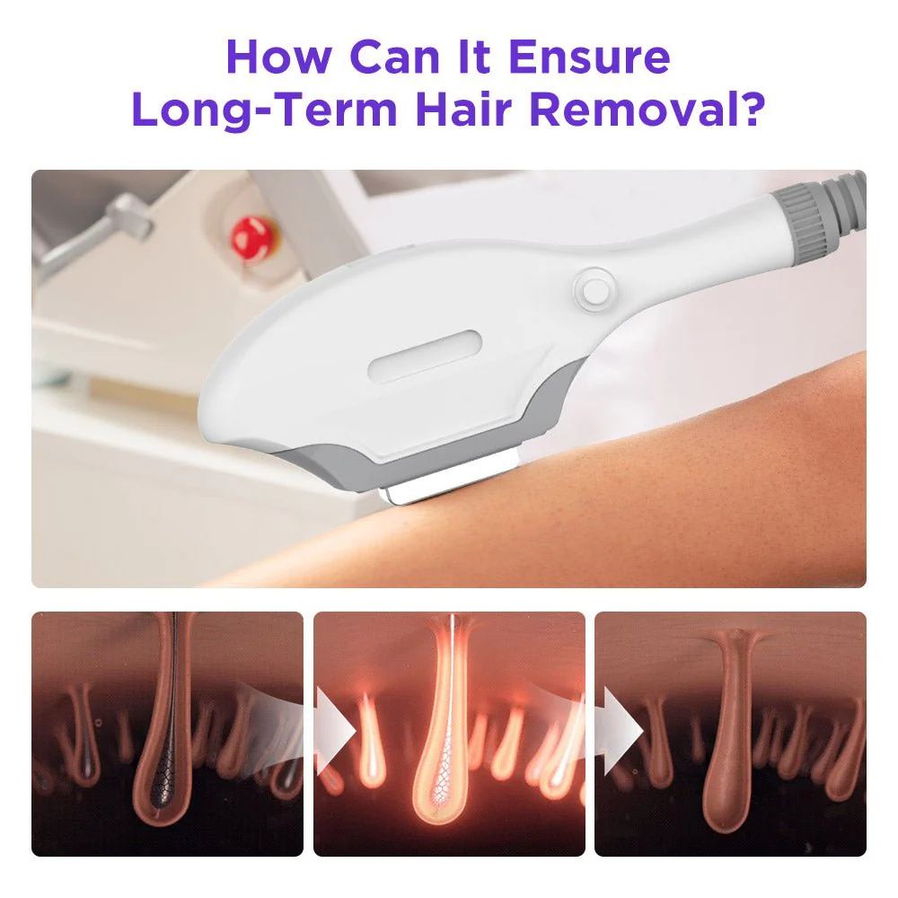 Shape Tactics IPL Laser Hair Removal Machine - Image 10