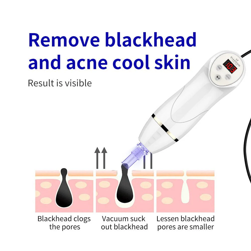 Shape Tactics Microdermabrasion Vacuum Spray for Deep Facial Cleansing - Image 15