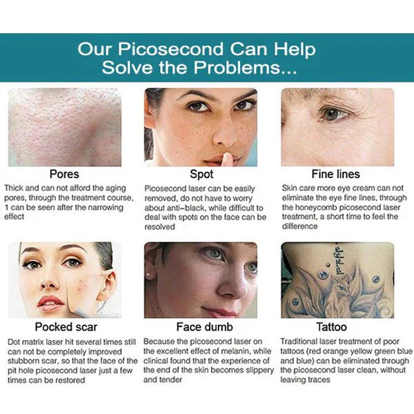 Shape Tactics - Precision Picosecond Laser: Tattoo Removal & Skin Renewal - Image 8